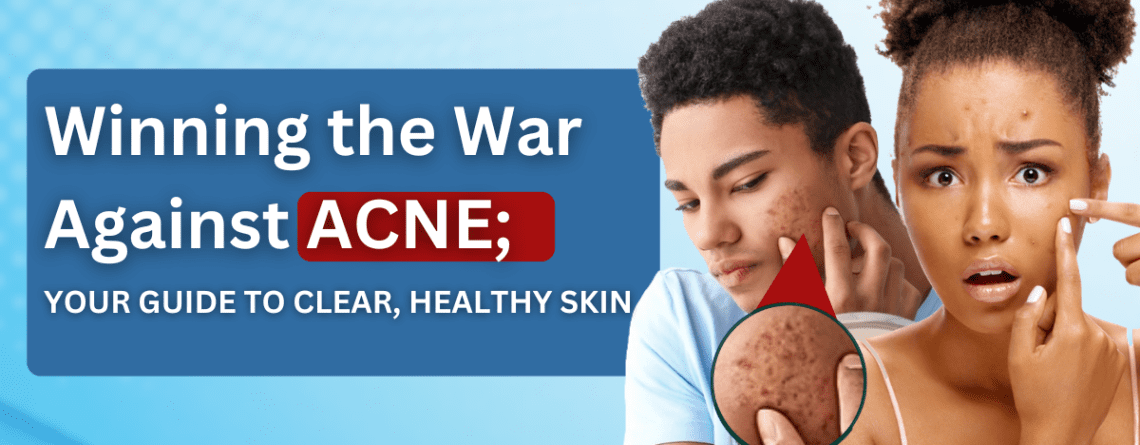 Acne, Acne vulgaris, Acne treatment, Clear skin, Healthy skin, Acne causes, How to treat acne,