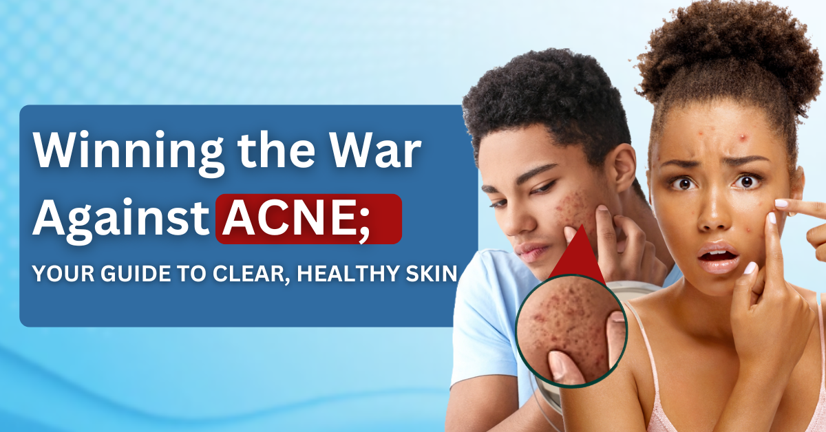 Acne, Acne vulgaris, Acne treatment, Clear skin, Healthy skin, Acne causes, How to treat acne,